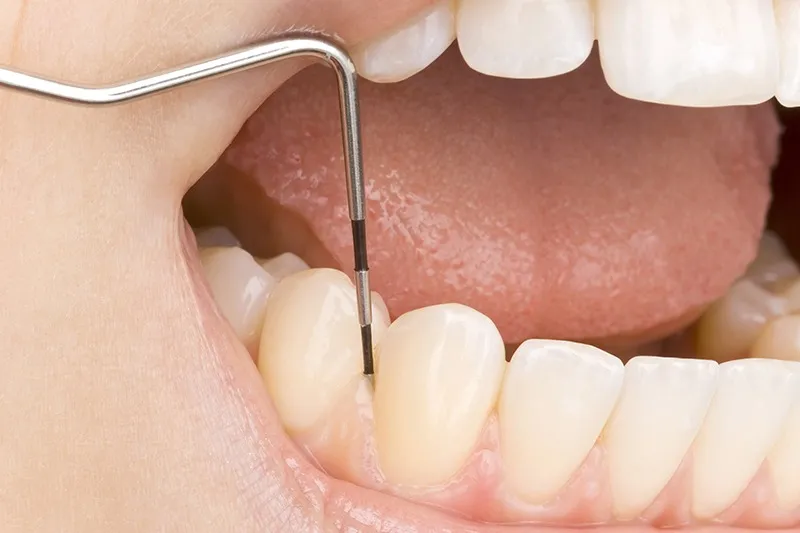 虫歯から歯周病まで様々な治療に対応